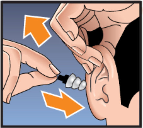 Hearos High Fidelity Ear Plugs Protectores Auditivos + Case